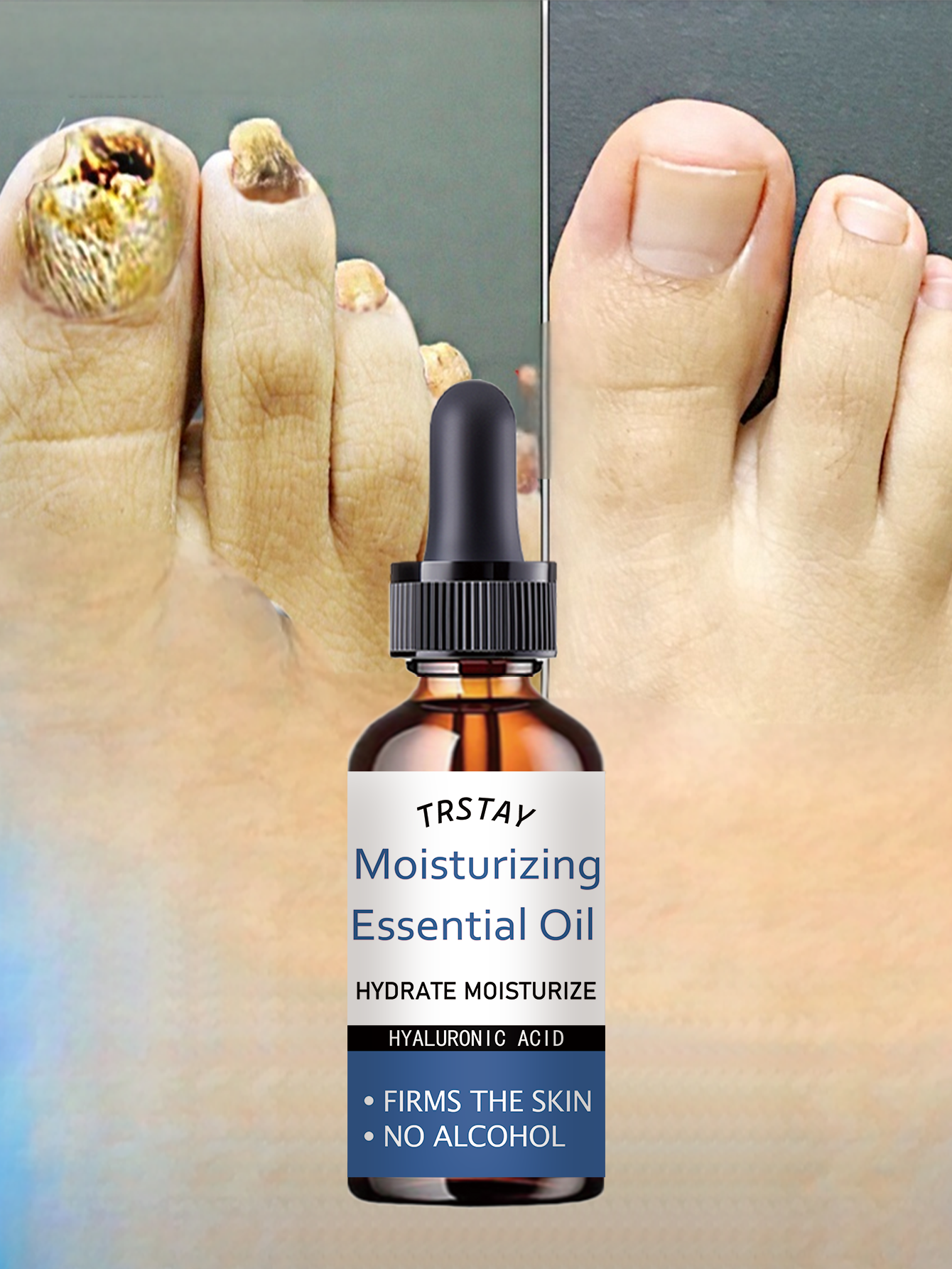Cuticle Oil for Nail Repair & Growth - Moisturizing Formula