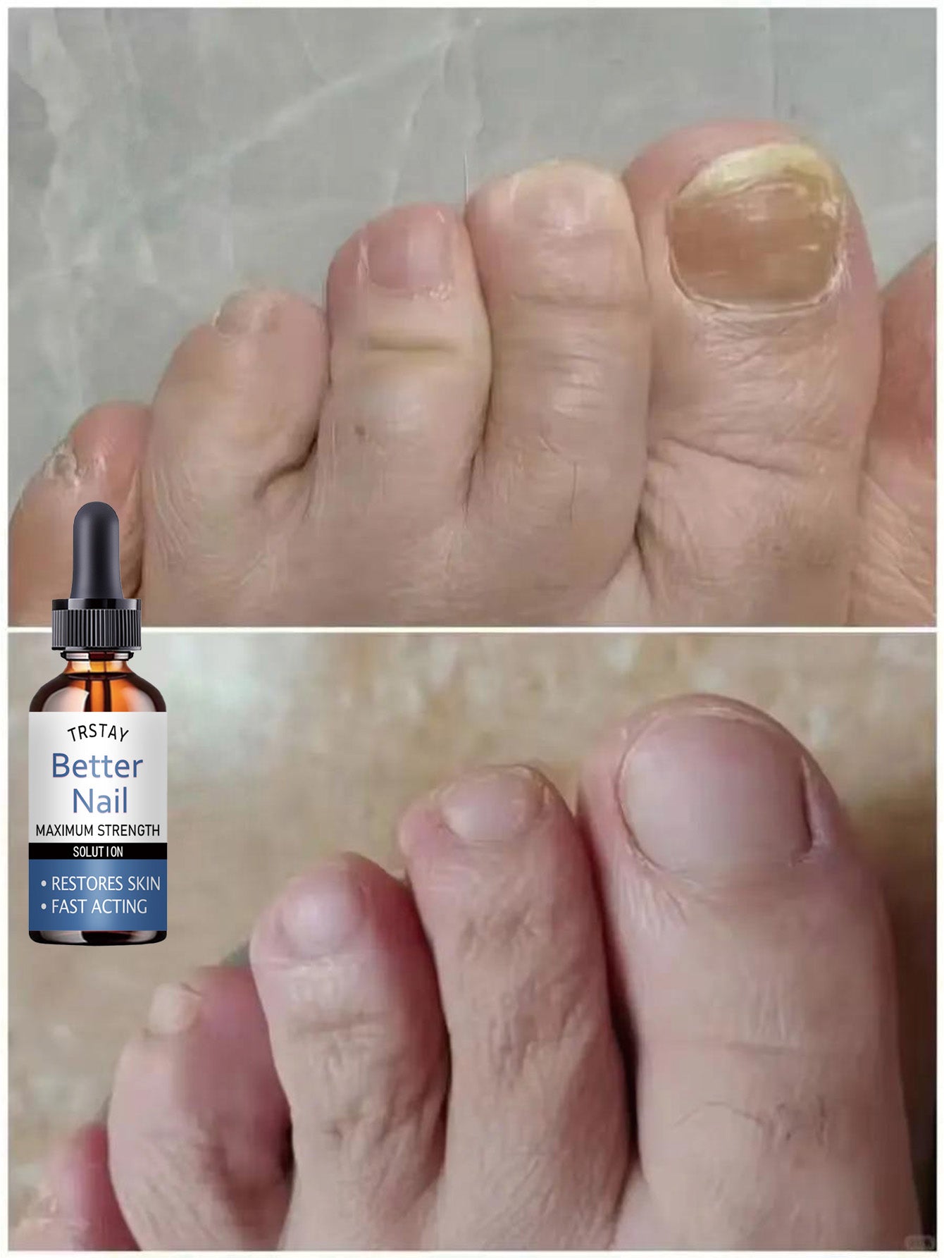 Cuticle Oil for Nail Repair & Growth - Moisturizing Formula