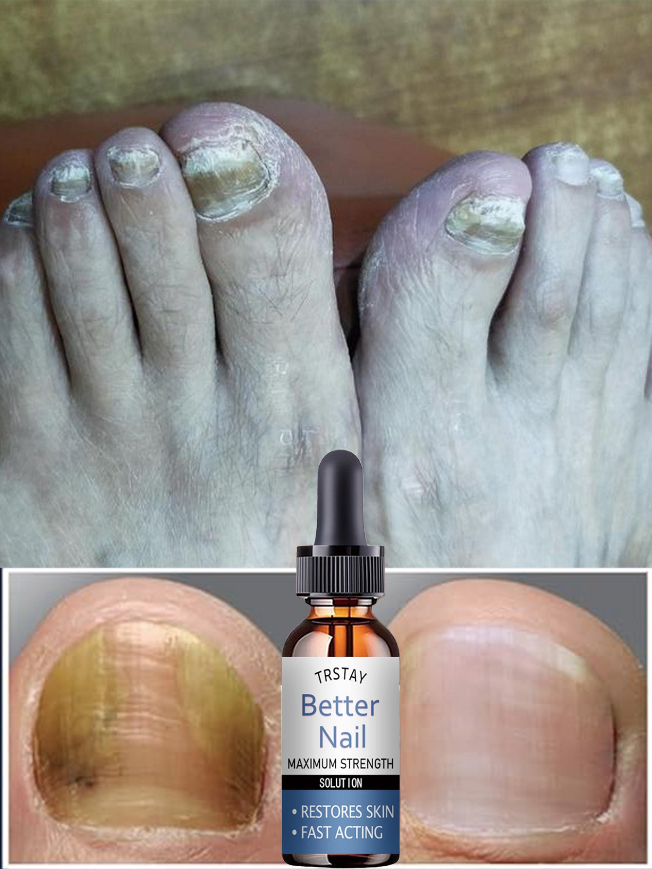 Cuticle Oil for Nail Repair & Growth - Moisturizing Formula