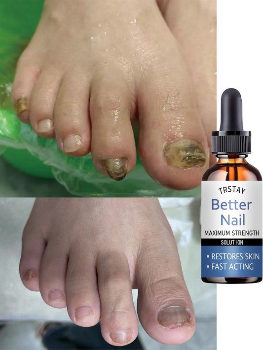 Cuticle Oil for Nail Repair & Growth - Moisturizing Formula